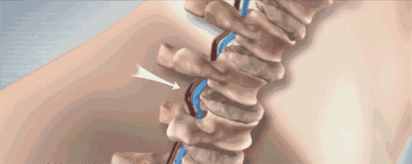 微信图片_20221213154222.gif